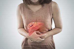 How Can I Manage Nonalcoholic Steatohepatitis?