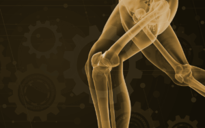 New Robotic-Assisted Joint Care